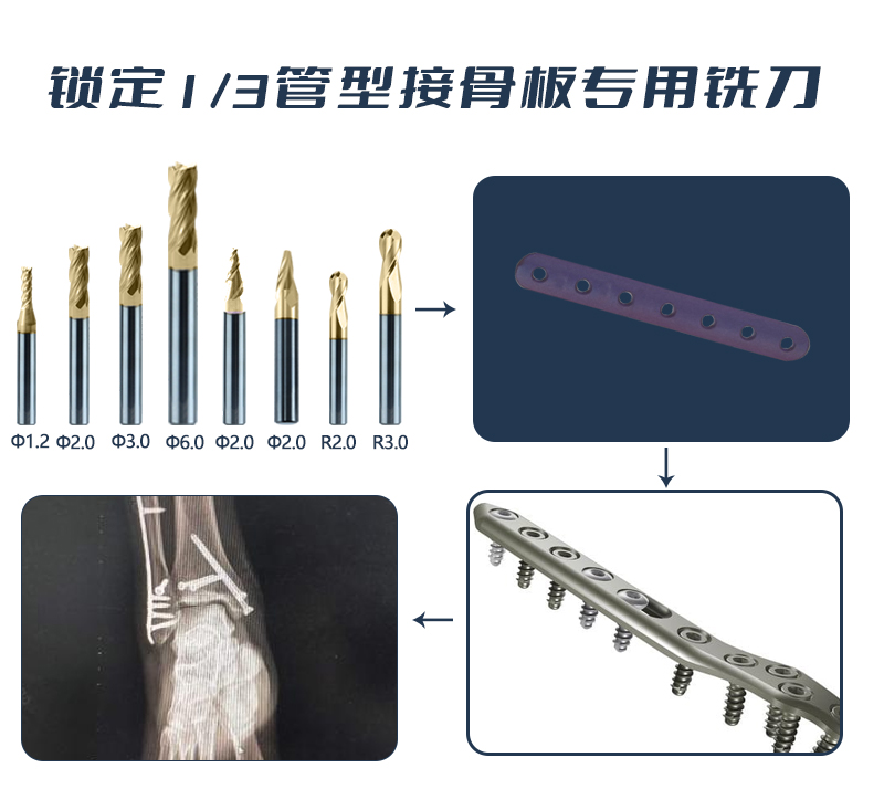 鎖定三分之一管型接骨板